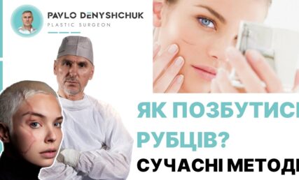 Как избавиться от рубцов? СОВРЕМЕННЫЕ МЕТОДЫ