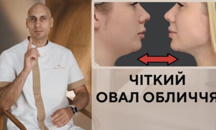 Підтягнути овал обличчя. Чіткий контур обличчя з лігатурною підтяжкою